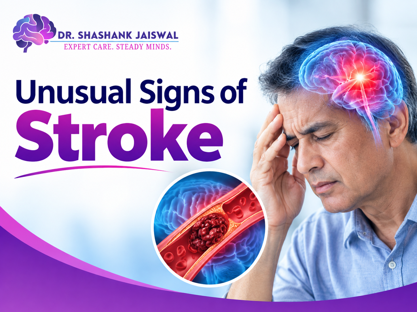Unusual Signs of Stroke: When It’s Not FAST