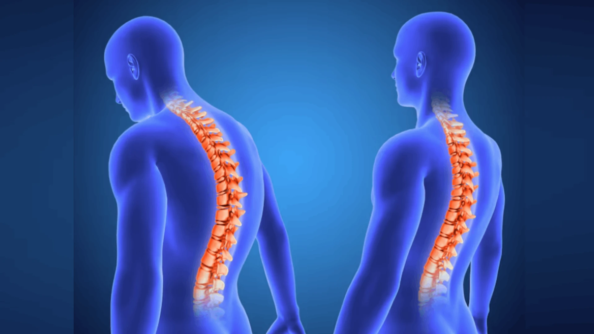 Brain & Spinal Cord Injuries - Dr Shashank