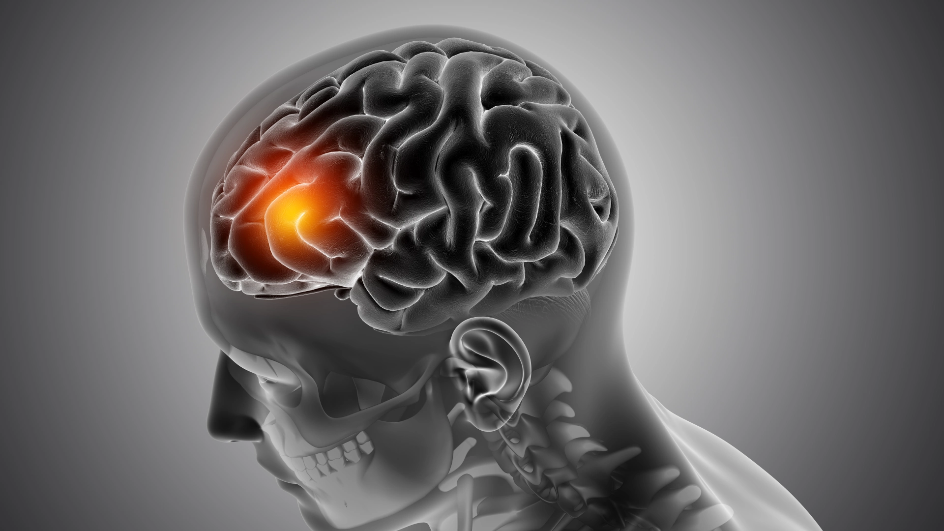 The Brain’s Silent Alarms: Recognizing Brain Tumours Early